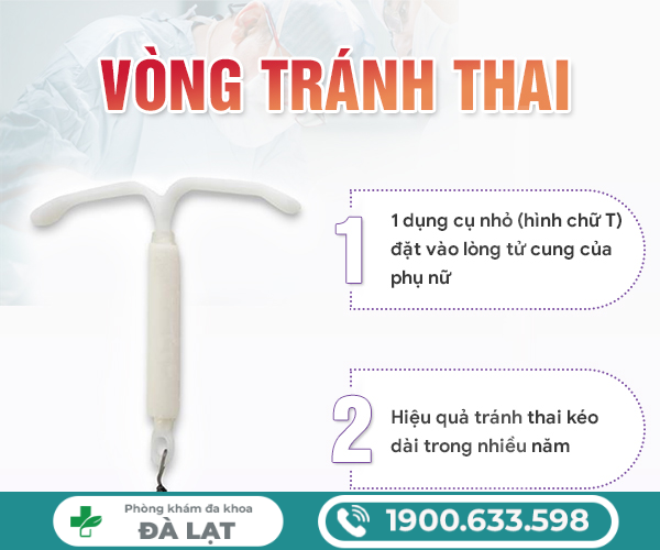 Hình ảnh minh họa